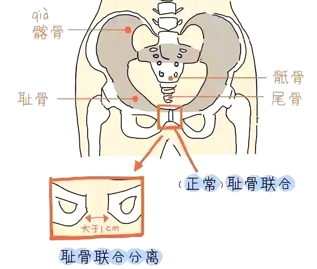 盆底肌康復(fù)治療儀，產(chǎn)后媽媽不再擔(dān)心