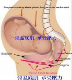 產(chǎn)后盆底康復(fù)治療開始后，出現(xiàn)陰道出血怎么破？