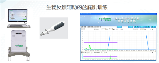 產(chǎn)后修復(fù)|盆底肌肉功能電刺激有什么作用？生物反饋呢？