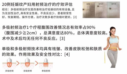 通澤產后塑形儀器，多極射頻破解辣媽逆齡秘訣