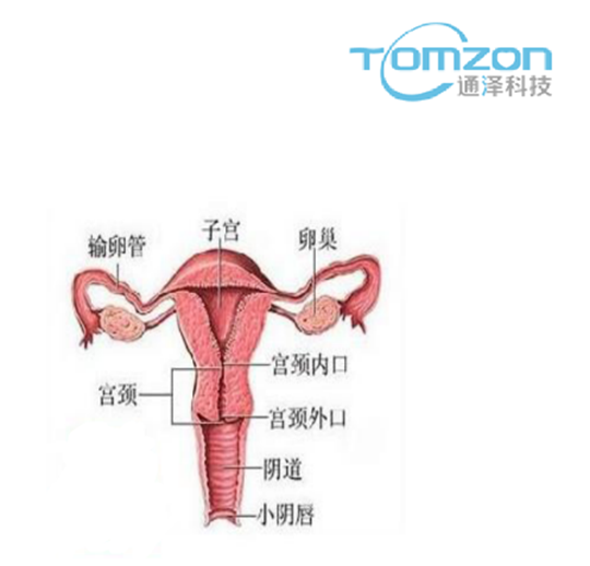 關(guān)注產(chǎn)后女性健康，子宮修復(fù)儀器的重要性