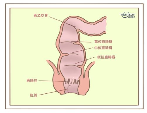 盆底康復(fù)治療儀對(duì)產(chǎn)后便秘有哪些幫助？