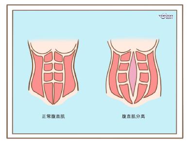 盆底康復(fù)治療儀效果到底怎么樣？