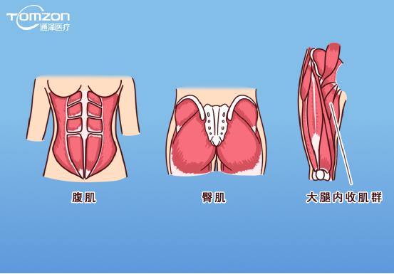 凱格爾運動該怎么做？盆底肌修復(fù)儀器還能用嗎？