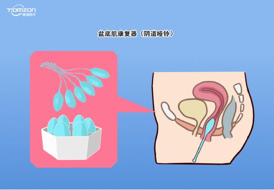 如有盆底高張者，不做力量提升型運(yùn)動，否則容易加重盆底損傷。建議在做盆底康復(fù)運(yùn)動前，先進(jìn)行盆底肌肉檢測