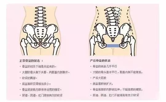 腹直肌修復(fù)