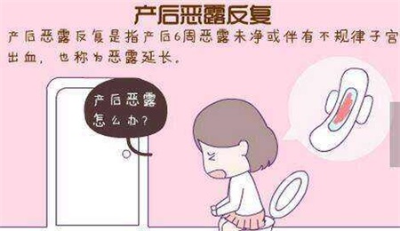 子宮復舊儀器