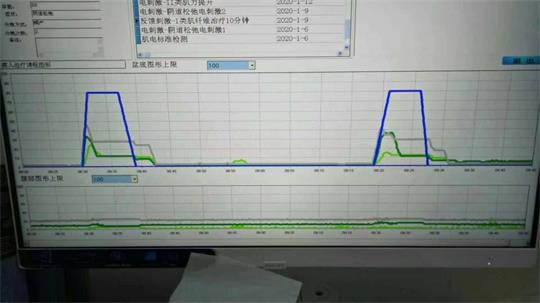 通澤醫(yī)療盆底肌儀器.jpg